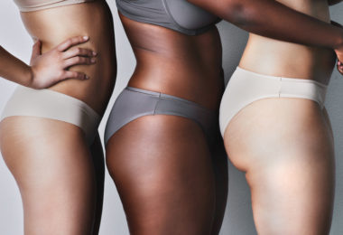 Appearance of Cellulite