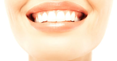 Cosmetic dentistry