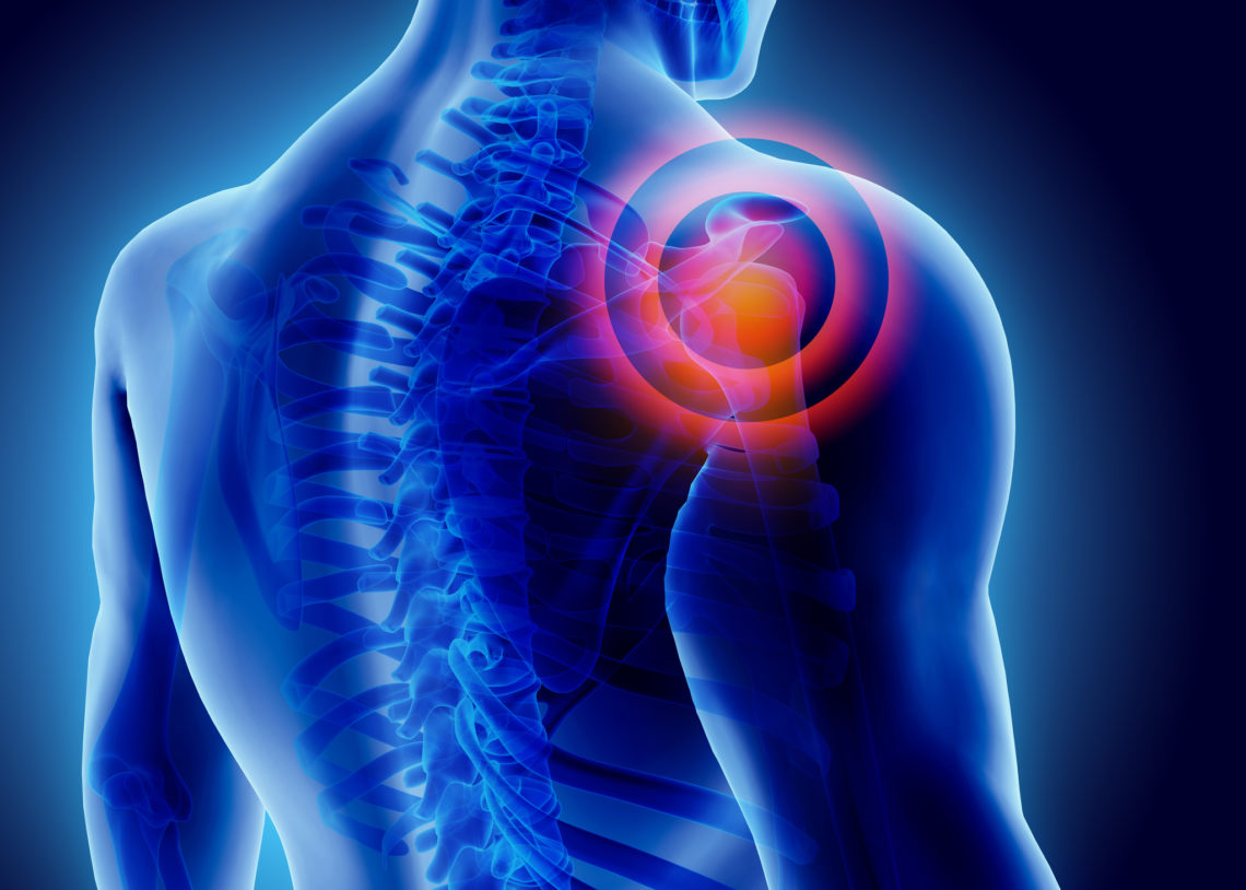 Minimize Shoulder Pain At Night By Loel Payne M D Health Journal