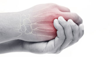 Fibromyalgia and Arthritis