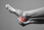 Plantar Fasciitis heel pain