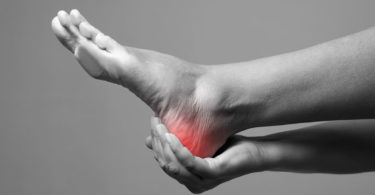 Plantar Fasciitis heel pain