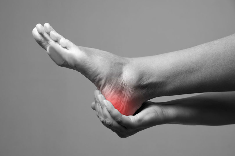 Plantar Fasciitis heel pain