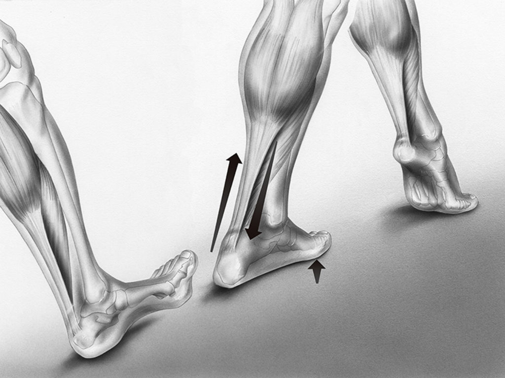 What causes achilles tendonitis health journal