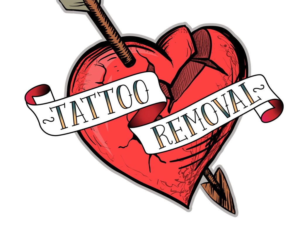 What is tattoo removal? | by Drsayalithakare | Medium