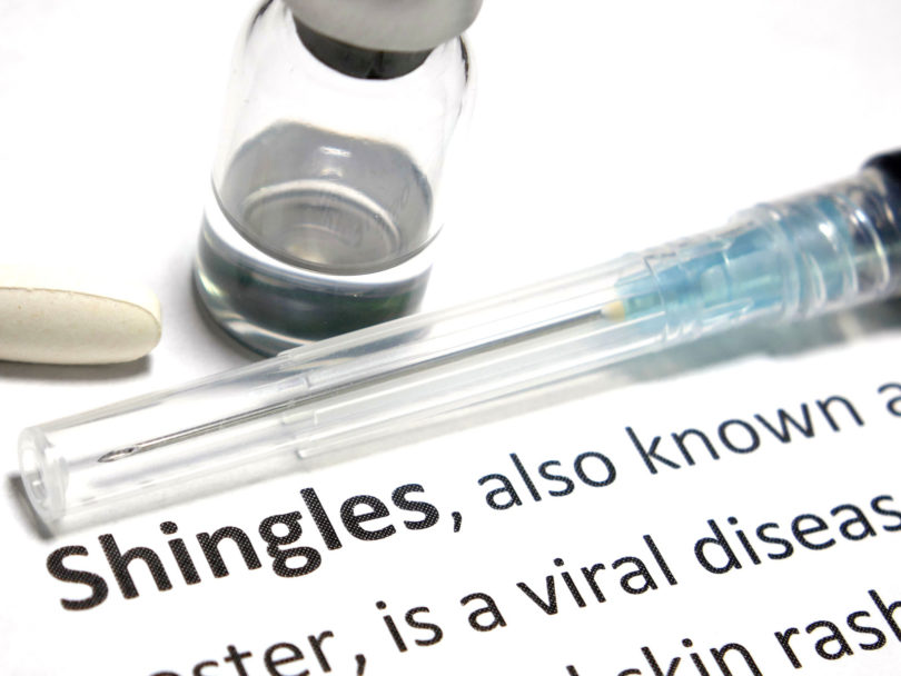 Shingles