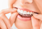 orthodontics