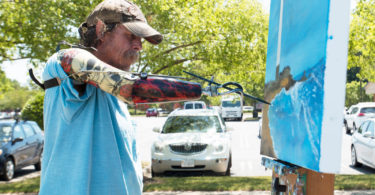 Man Who Lost Arms in an Electrical Accident