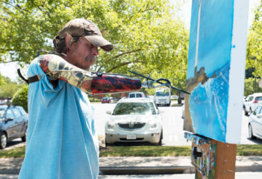 Man Who Lost Arms in an Electrical Accident