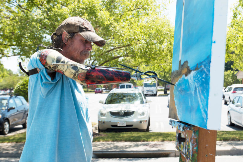 Man Who Lost Arms in an Electrical Accident