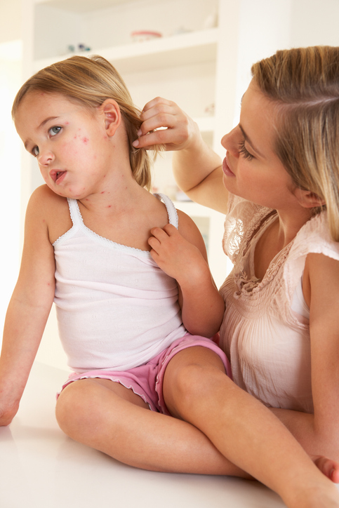 Rashes in children