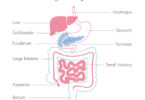 gastroparesis