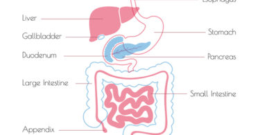 gastroparesis