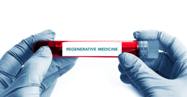 regenerative medicine