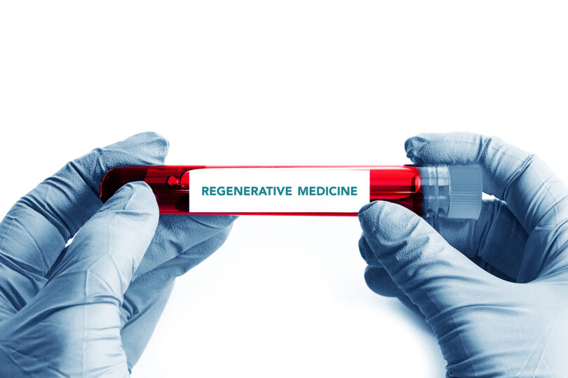 regenerative medicine